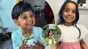 Tiene solo 6 años, pero “parece una anciana”: Thakku enfrenta una rara enfermedad y sueña con ser doctora