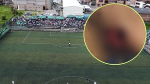 Insólito: torneo de fútbol "Por la Paz" en Santa Rosa de Osos terminó con un jugador mordido en el rostro