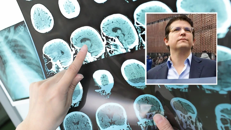 Foto de radiografía cerebral y foto de Miguel Uribe.