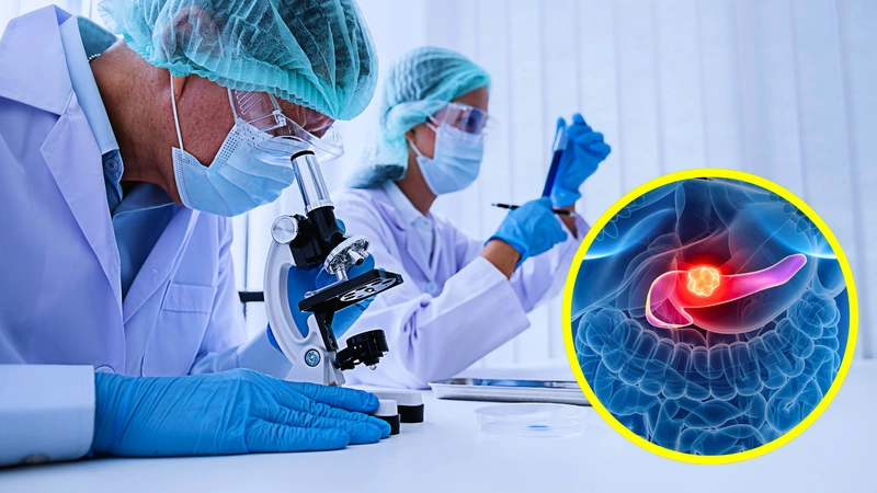 Encuentran señal que ayuda a diagnosticar el cáncer de páncreas.