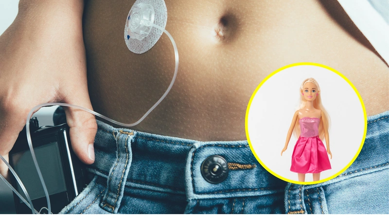 Nueva Barbie con diabetes tipo1.