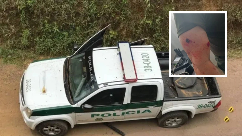 El hostigamiento contra la Fuerza Pública en Antioquia le ocasionó una herida de bala en el brazo al comandante operativo de la Policía Antioquia. La imagen principal es de referencia y no corresponde a la patrulla hostigada.