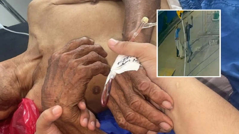 Imágenes del adulto mayor atacado con una piedra.