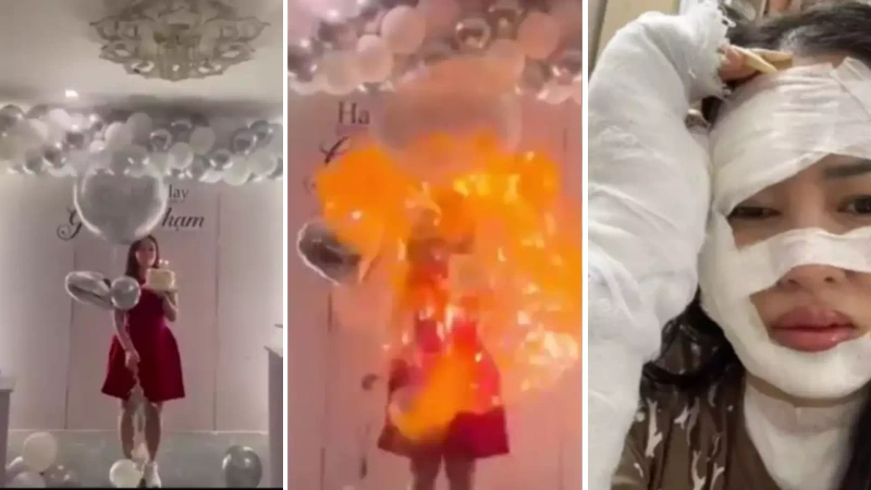 La imagen es un collage donde una mujer en medio de una celebración, sufre quemaduras en su rostro debido a un globo inflado con hidrogeno. Foto: TV Azteca