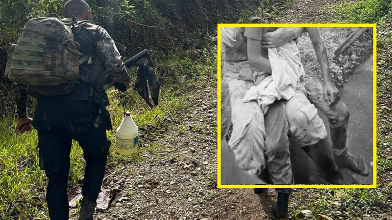 Uno de los niños perdió el brazo derechos tras activar el artefacto eplosivo sembrado por las disidencias de las Farc. Foto: Cortesía y archivo