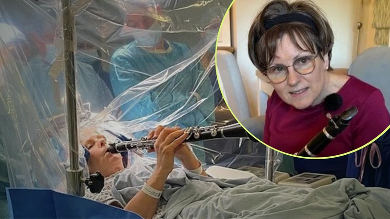Así fue la cirugía de Parkinson de Denise Bacon. Foto: Infobae/King's College Hospital.