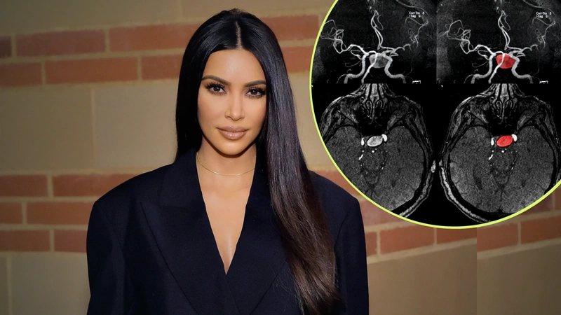 Así fue el diagnóstico de Kim Kardashian. Foto: Vogue México.