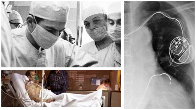 El implante de un segundo corazón manteniendo el primero activo no solo representa un hito quirúrgico, sino también una lección sobre la innovación y el valor humano en la medicina. Fotos: Redes Sociales