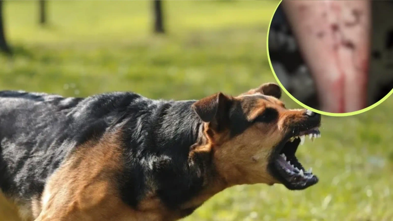 En l aimagen principal es de referencia tomada de Paraqueños, en detalle la mordida de un canino en el municipio de Entrerríos.