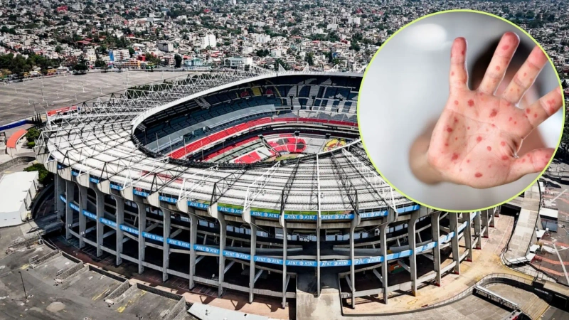 Alerta en México (ver detalle en la foto) por casos de Sarampión antes del Mundial.