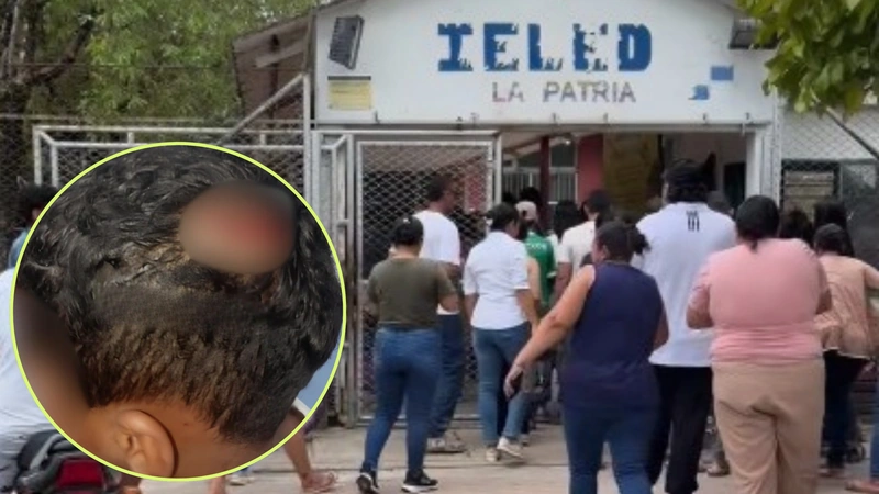 Tres menores heridos en Yondó tras caída de ventilador en institución educativa