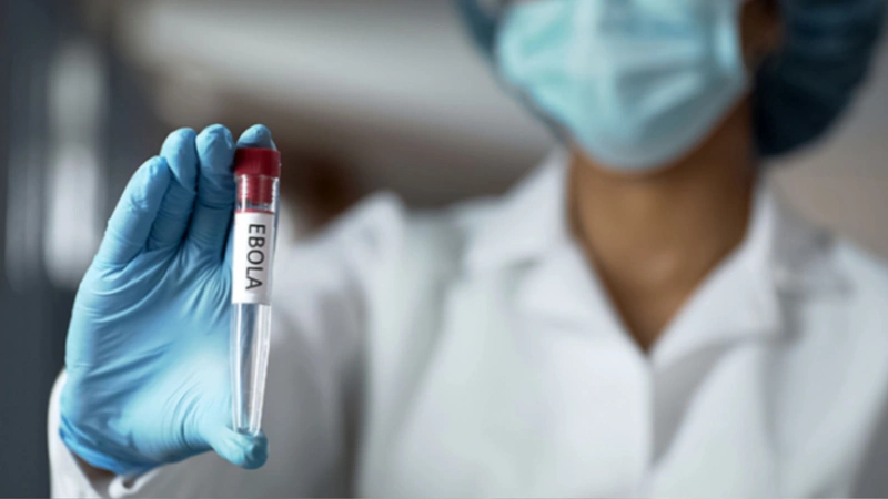 La OMS alerta sobre la expansión del ébola. Foto: tomada del observatorio de medicina de la Universidad Católica de Chile