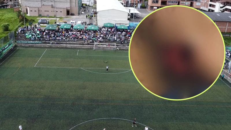Un jugador mordió el rostro de otro durante un torneo de fútbol en Santa Rosa de Osos. Fotos: cortesía