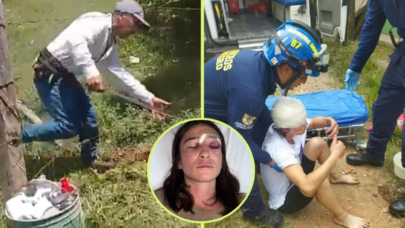 Lucero Arango Alzate permanece en recuperación luego de resultar herida en el rostro durante un ataque a machete ocurrido en zona rural de Rionegro. Fotos: cortesía