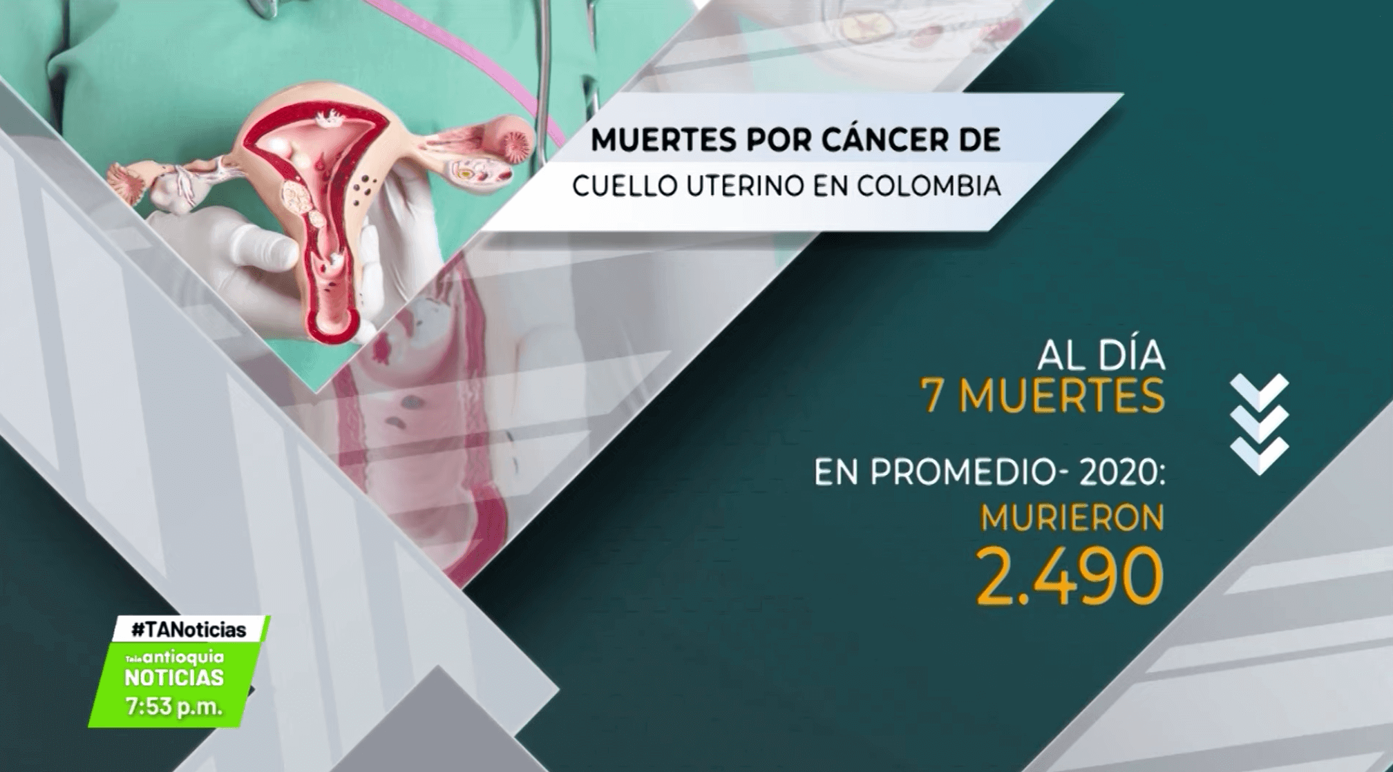 Buscan erradicar a 2030 cáncer de cuello uterino