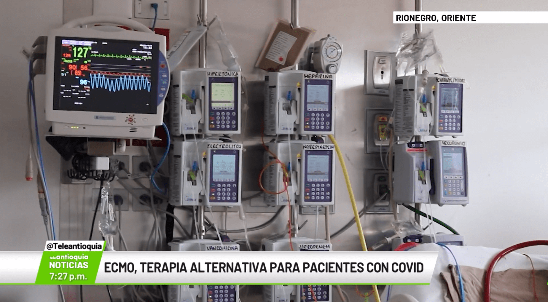 ECMO, terapia alternativa para pacientes con Covid