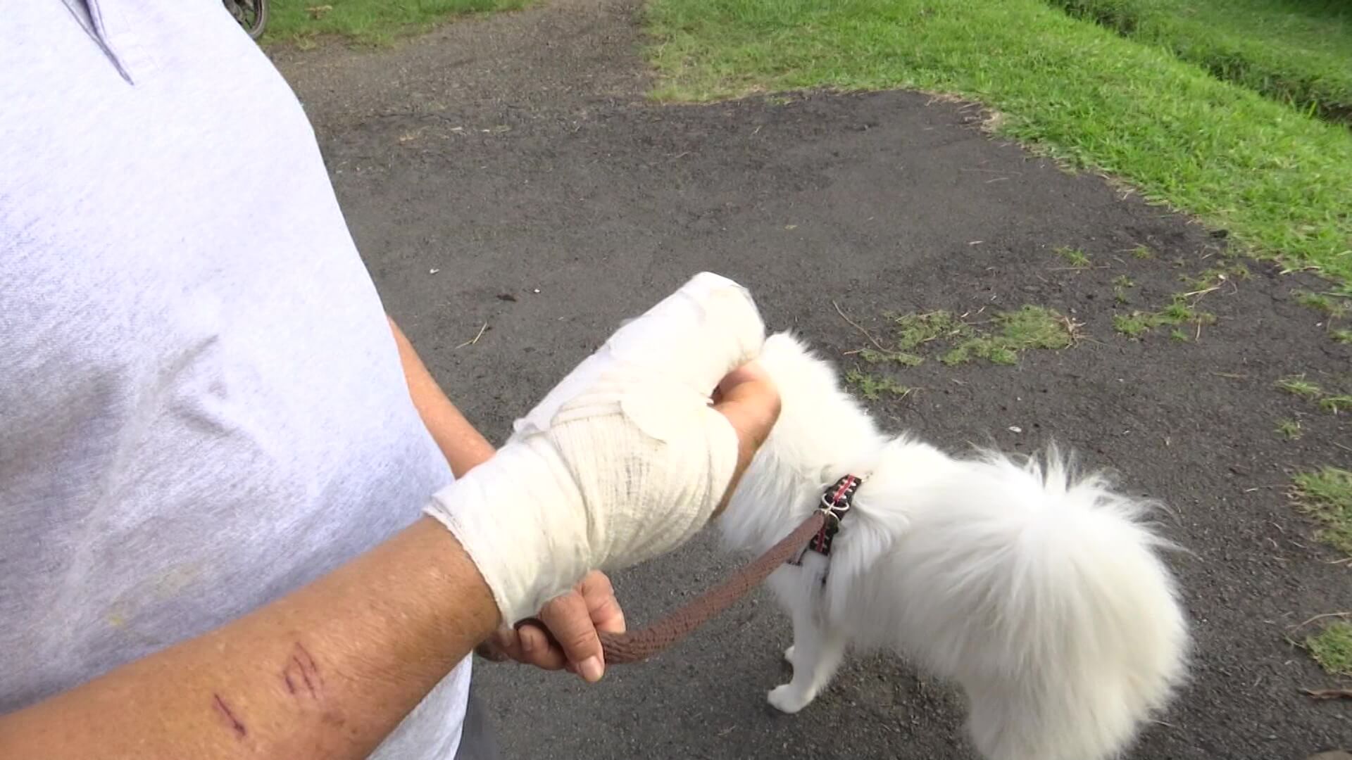 Pierde dedo pulgar tras ser atacado por un pitbull
