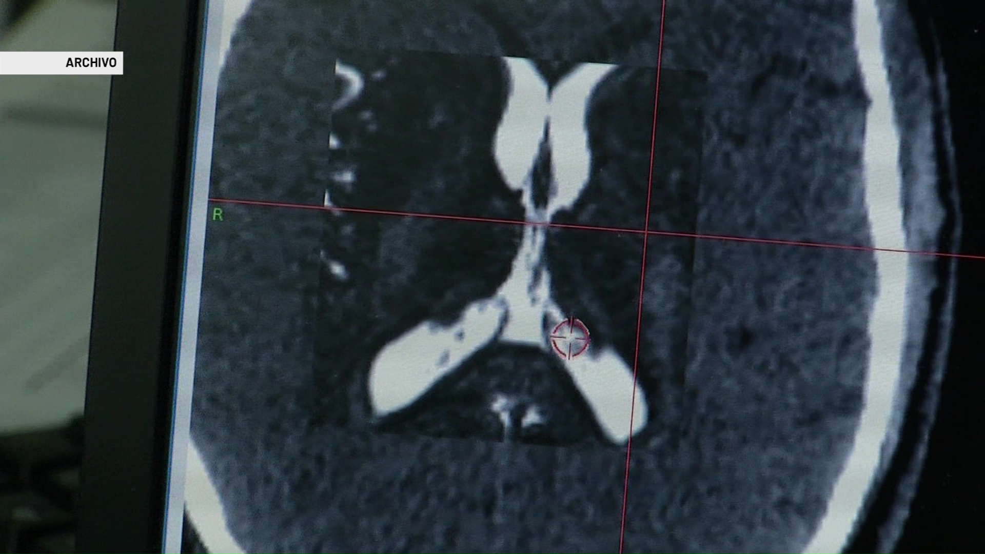 Molécula que ayuda a disminuir síntomas del Parkinson