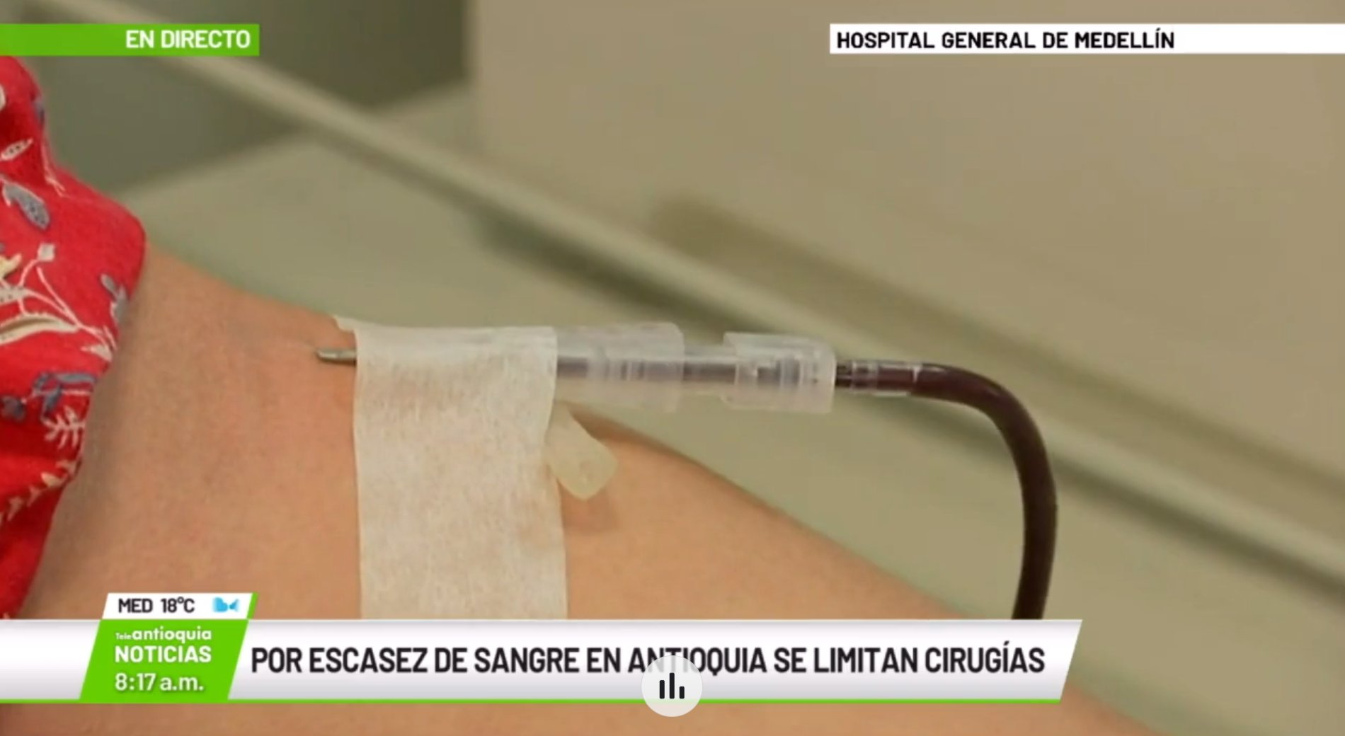 Por escasez de sangre en Antioquia se limitan cirugías