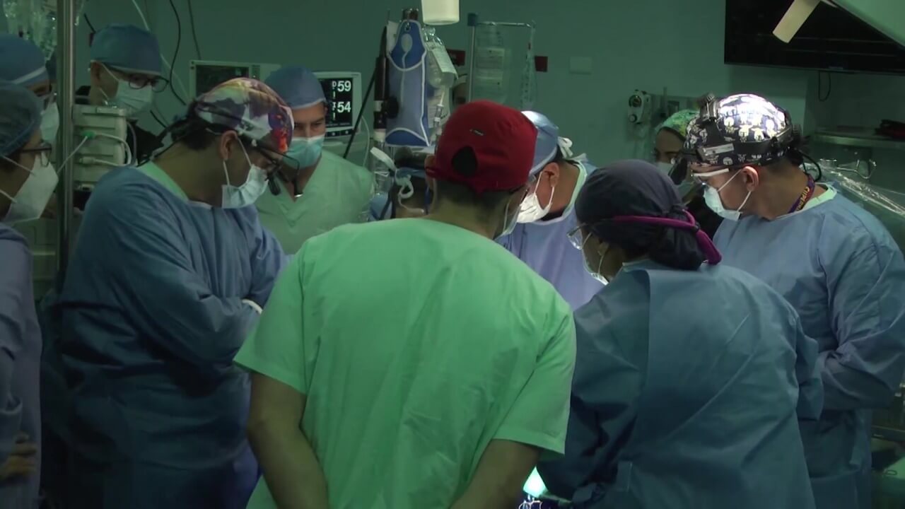 Primer implante para asistencia ventricular