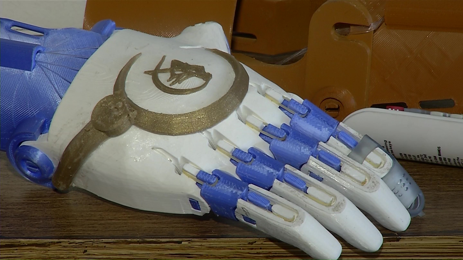 Personalizan prótesis hechas con impresión 3D
