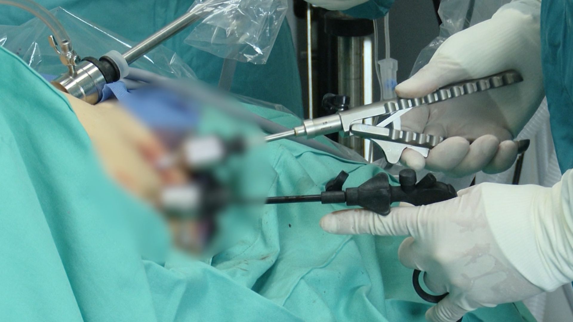 Investigan muerte mujer cirugía plástica