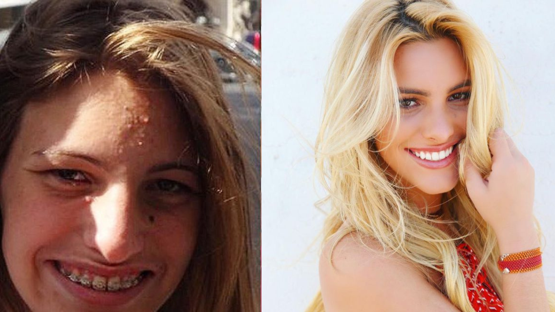 TOP 10: transformaciones más impactantes de las celebridades