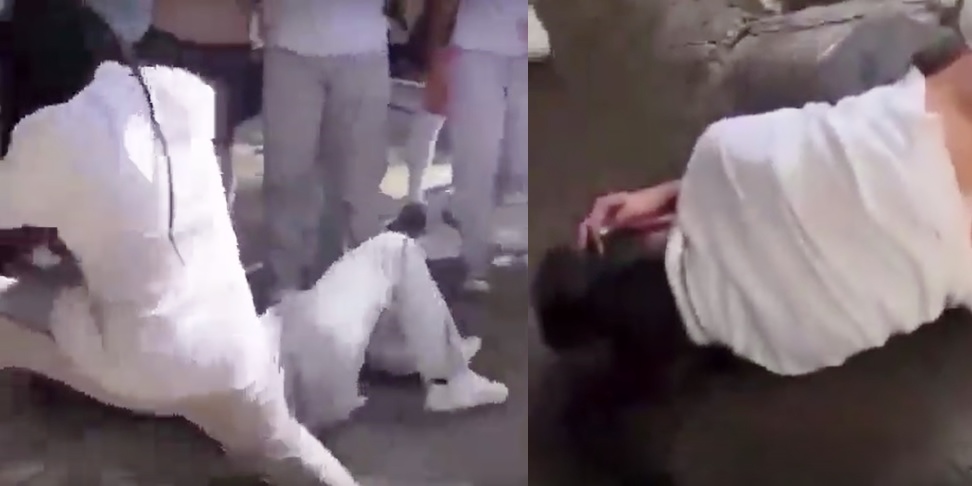 Estudiante con discapacidad cognitiva fue víctima de brutal golpiza