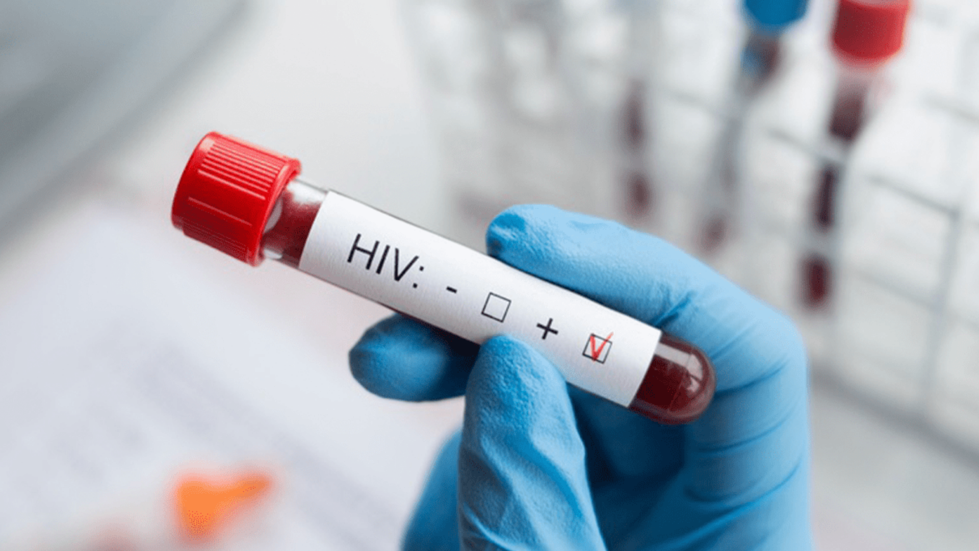 Verdades que desmienten mitos del VIH/SIDA: lo que todos deben saber