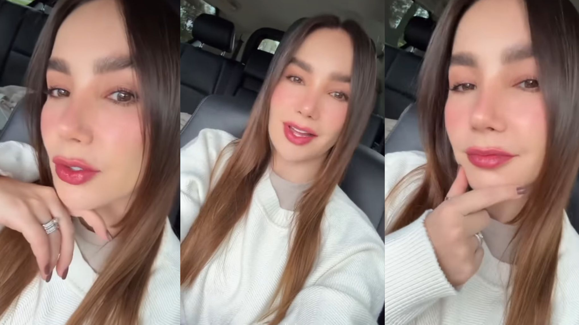 Lo compartió con sus seguidores: estos son los resultados de tratamiento estético de Paola Jara