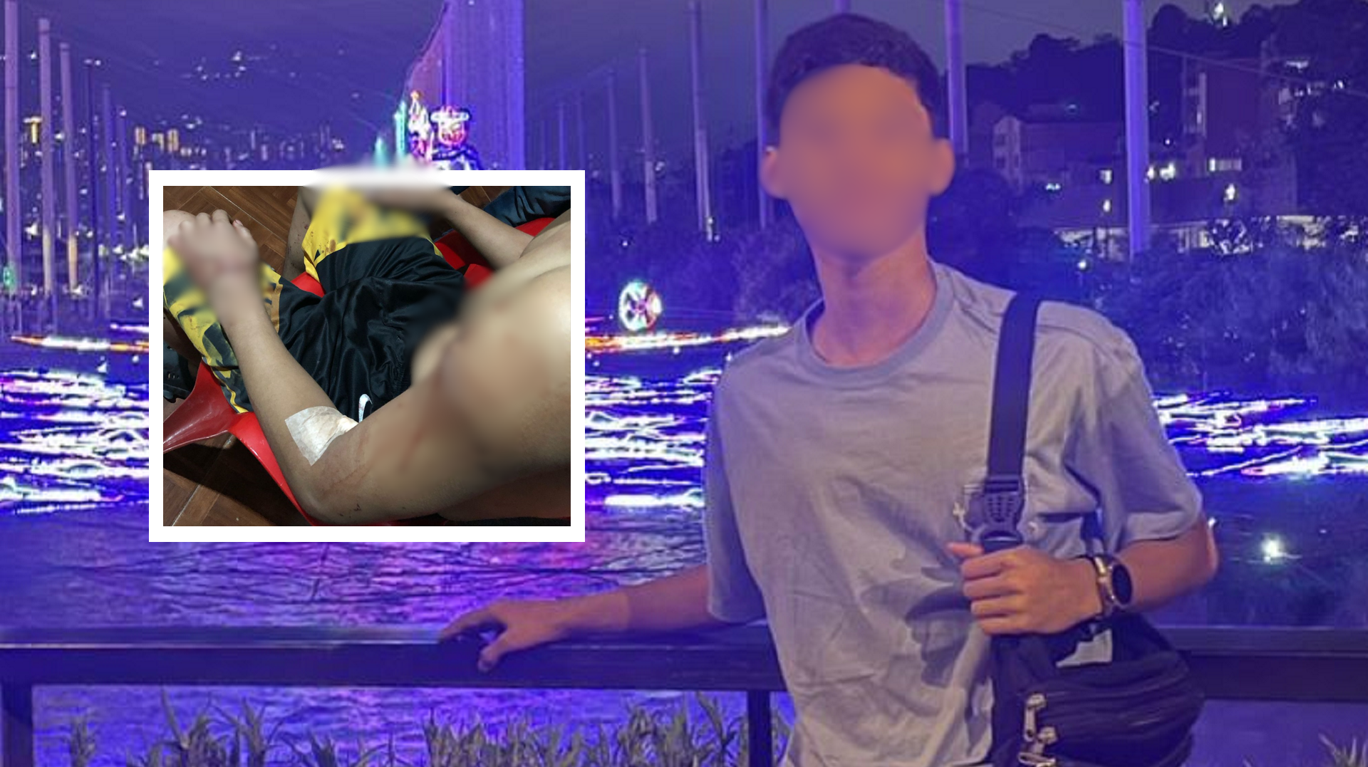 VIDEO | Por no tener celular un ladrón apuñaló cinco veces a menor de 16 años en Medellín
