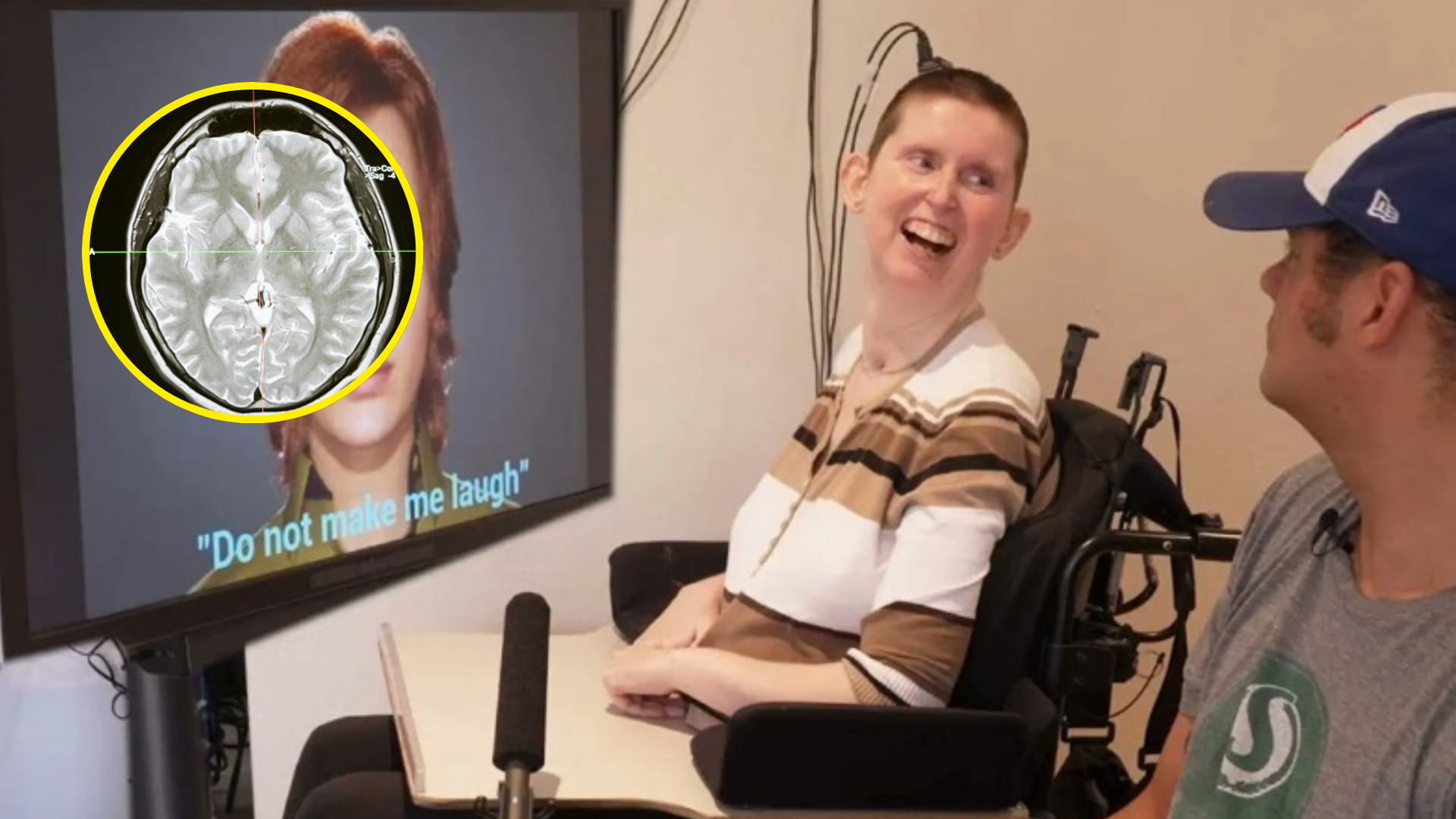 Innovador implante cerebral permite a una mujer hablar de nuevo después de 18 años