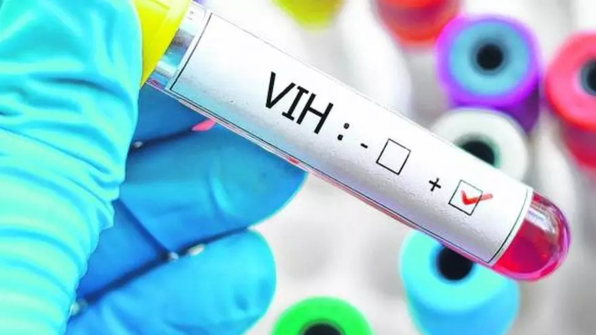 ¡Alerta en Colombia! El VIH se propaga y los jóvenes son los más afectados
