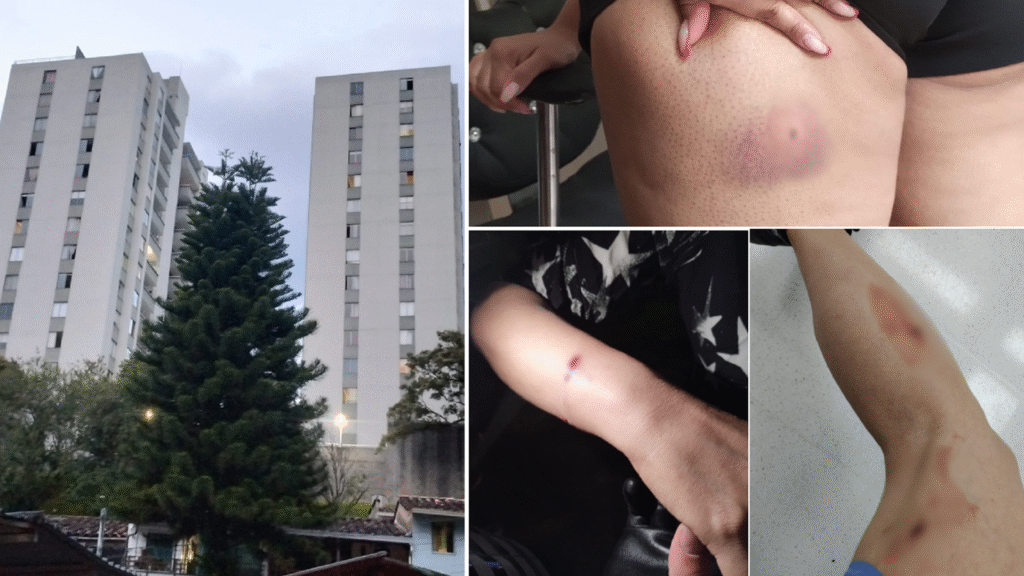 Se hablan de, por lo menos, 7 heridos. La Policía aún no se pronuncia sobre el caso del cual tiene conocimiento desde el pasado 9 de julio. Fotos: Cortesía
